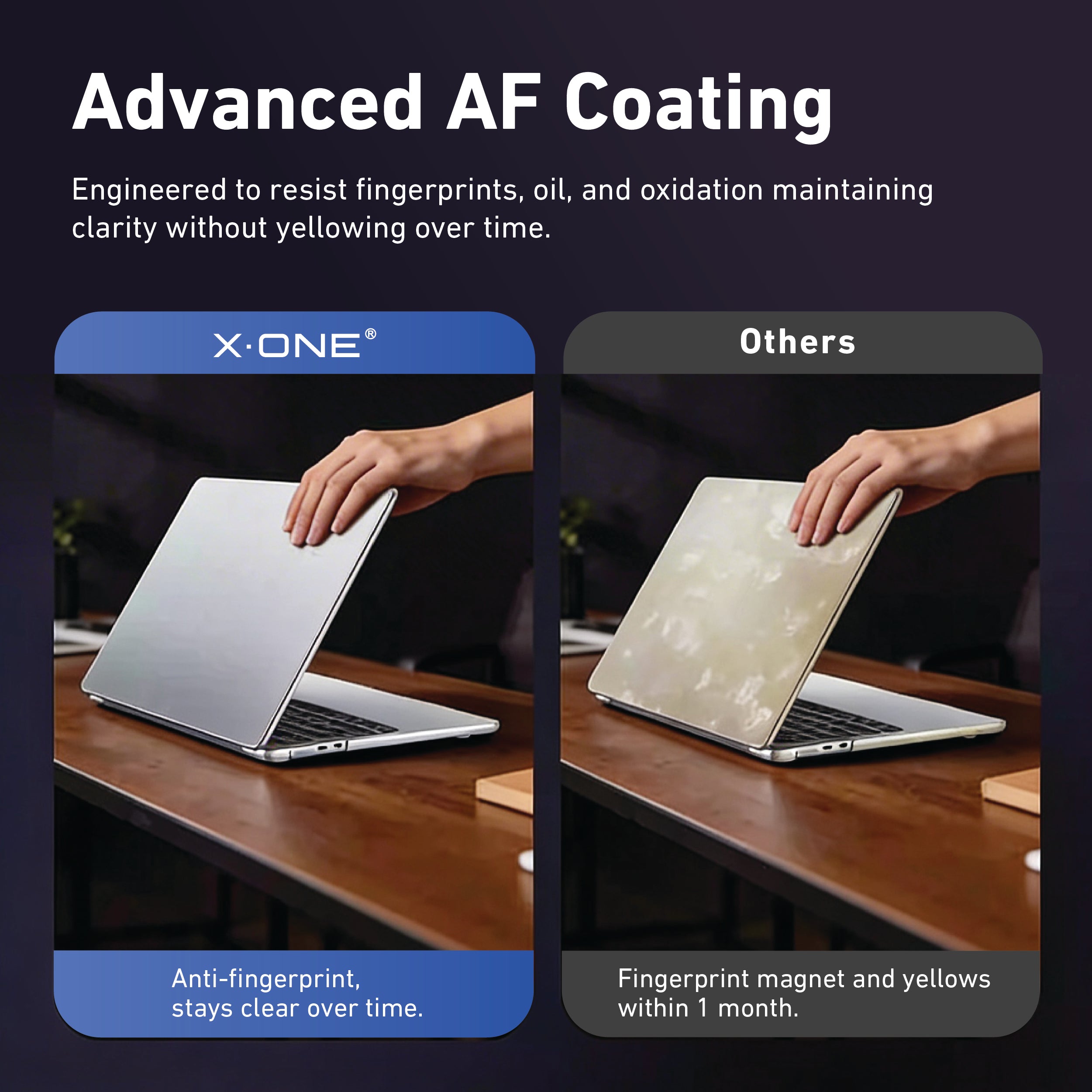 X.One® Aero Case for MacBook NEO — Feature 5